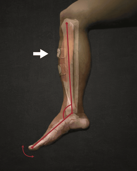 A neuromuscular stimulation electrode made from a silver–hydrogel composite provides a skin-compatible interface for bioelectronics for stimulating muscle movement.